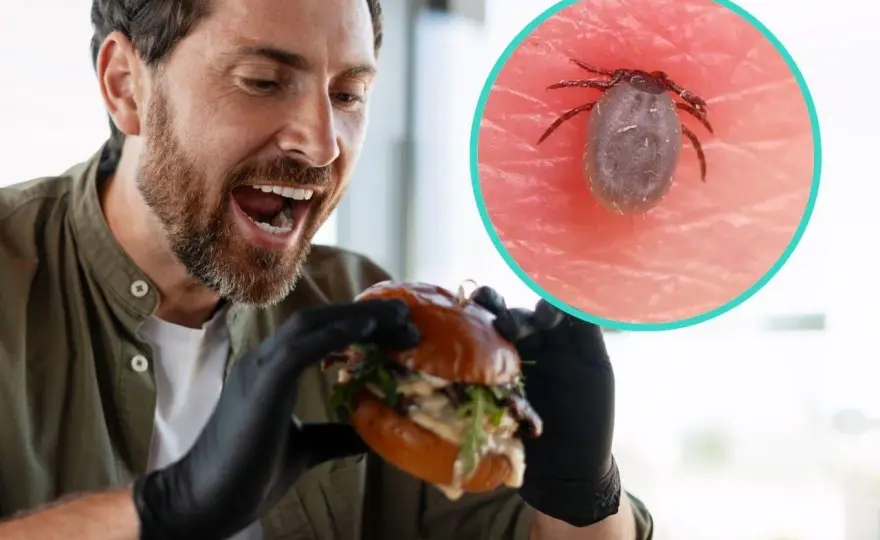 Zespół alfa-gal - alergia na mięso po kleszczu? Objawy, leczenie
